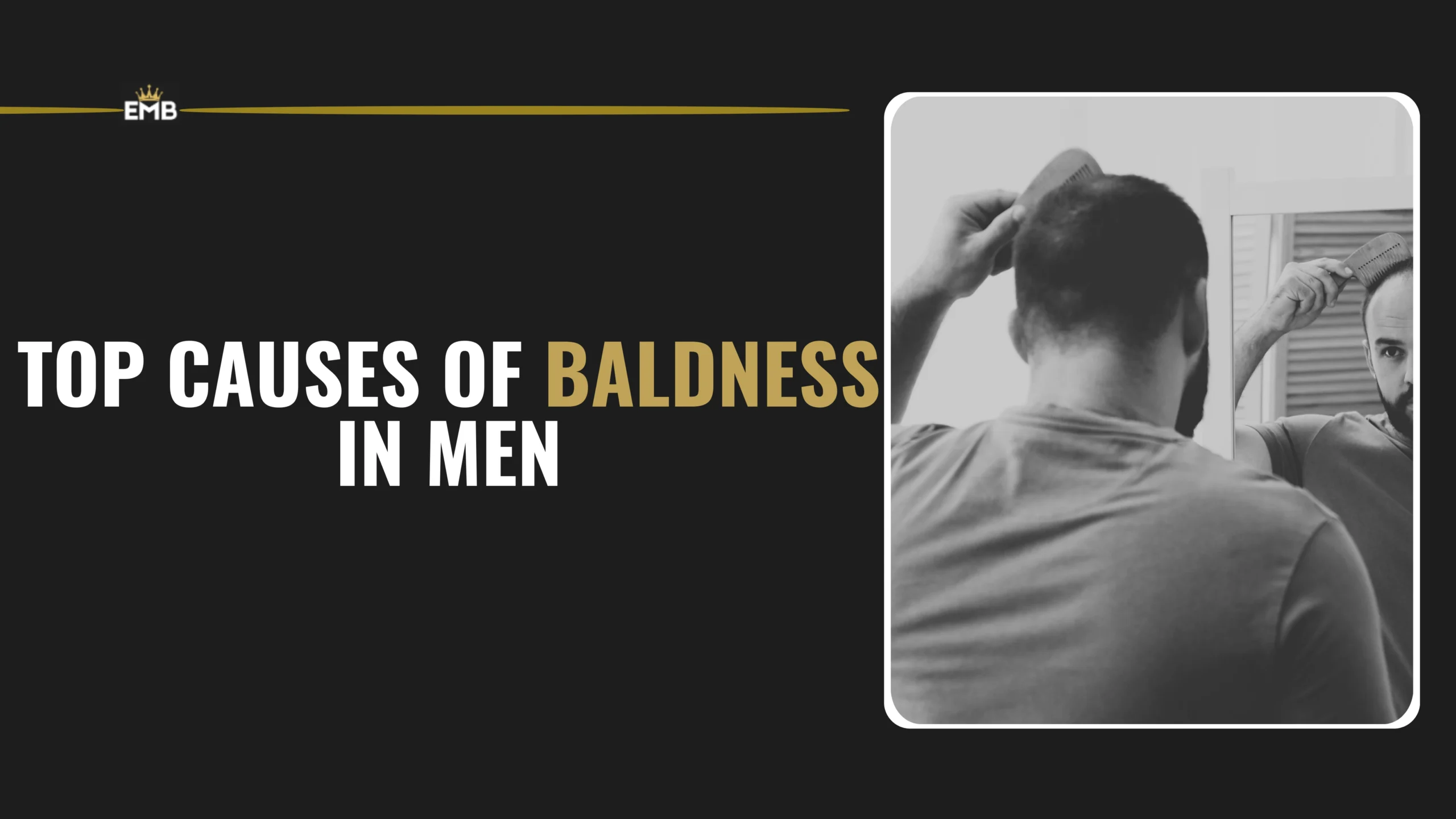Top Causes of Baldness in Men